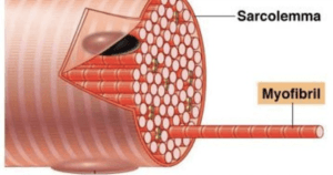 dolor muscular de aparición tardía (agujetas)