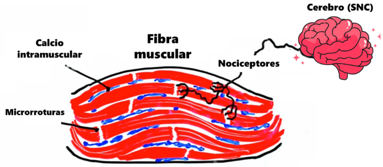 daño muscular de las agujetas